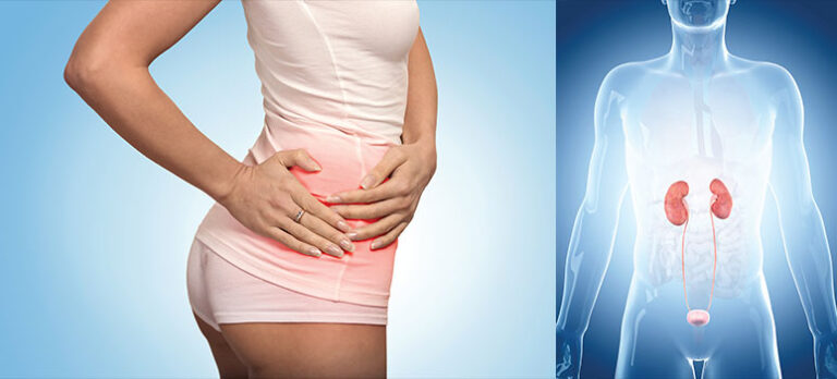 212f7f53ef2255f5785bcfdb62d825a4