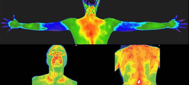 medical thermography