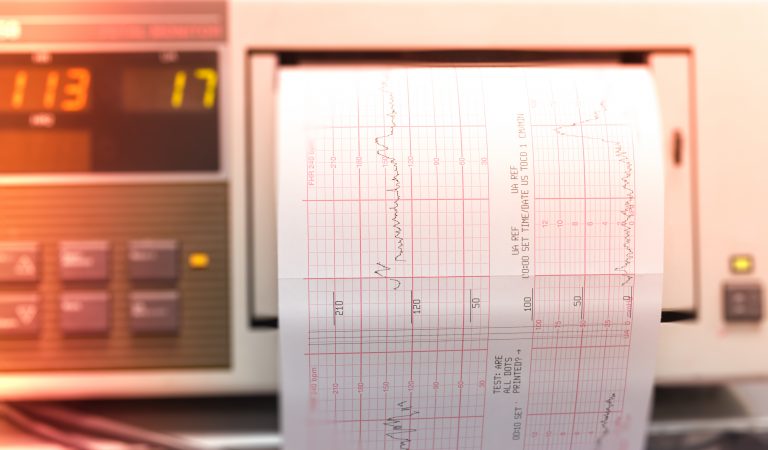 Printing,Of,Cardiogram,Report,Coming,Out,From,Electrocardiograph,Iin,Delivery