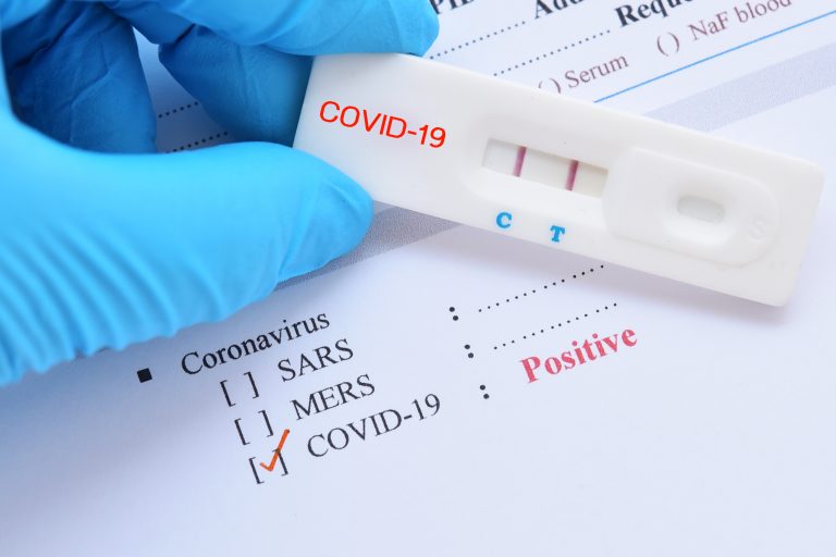Positive,Test,Result,By,Using,Rapid,Test,Device,For,Covid-19,