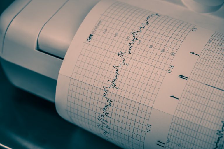 Printing,Richter,Scale,Of,Cardiogram,Beat,Report,Coming,Out,From