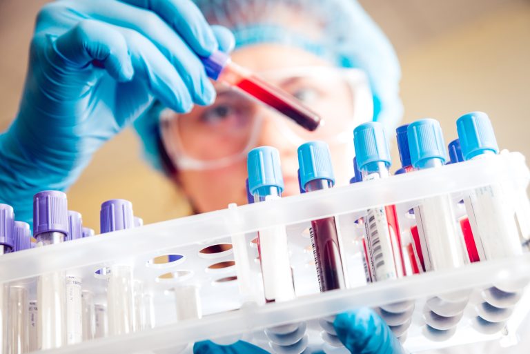 Medical,Equipment.,Blood,Test