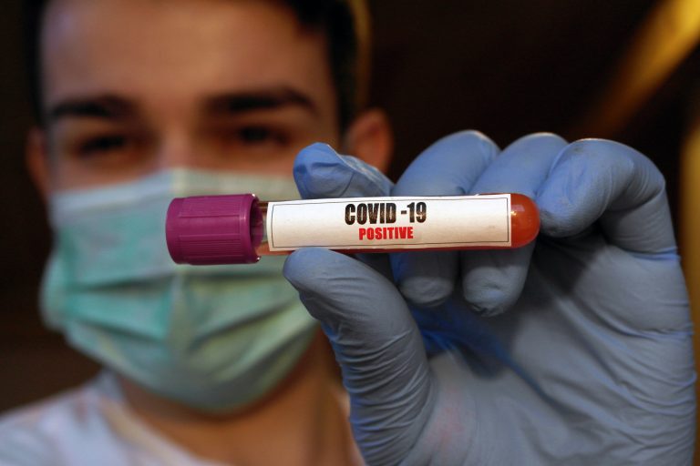 06/04/2020,Italy,Patient,Coronavirus,2019-ncov,Blood,Sample.,Corona,Virus,Outbreaking.
