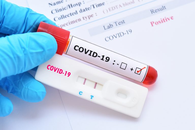 Positive,Test,Result,By,Using,Rapid,Test,Device,For,Covid-19
