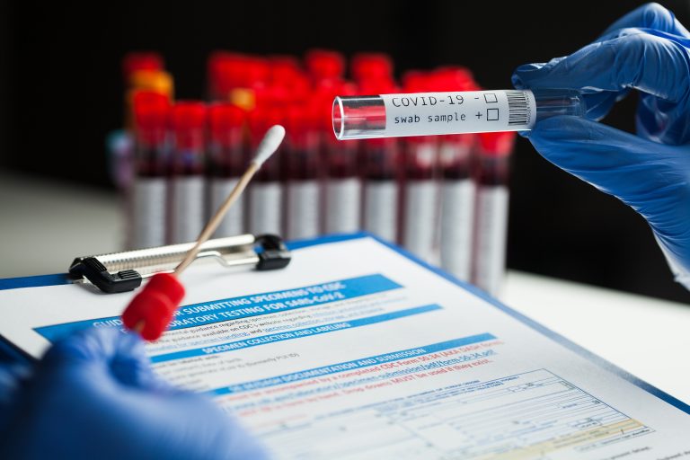 Rt-pcr,Covid-19,Virus,Disease,Diagnostic,Test,lab,Technician,Wearing,Blue,Protective