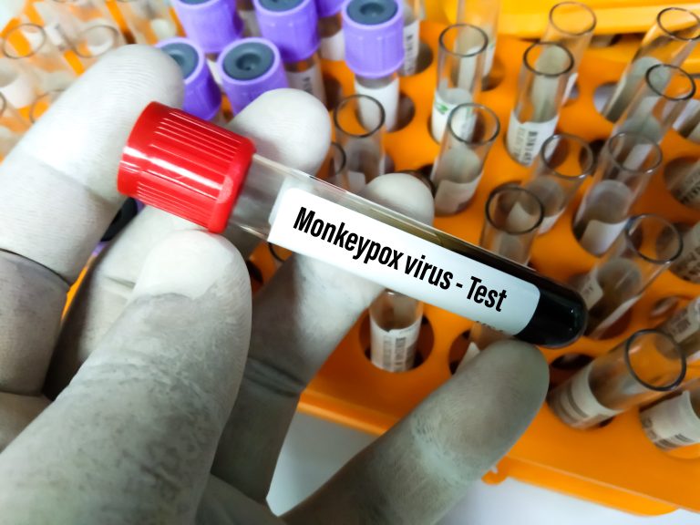 Blood,Sample,Tube,For,Monkeypox,Virus,Test.,It,Is,Also