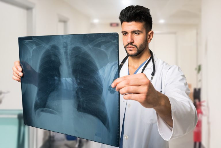 Doctor,Examining,A,Lung,Radiography