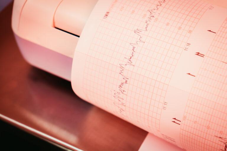 Printing,Richter,Scale,Of,Cardiogram,Beat,Report,Coming,Out,From