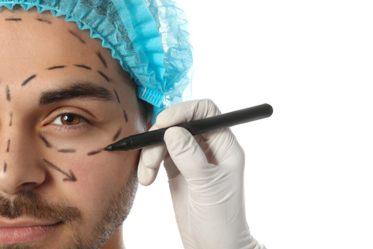 Doctor,Drawing,Marks,On,Man's,Face,For,Cosmetic,Surgery,Operation