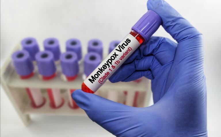 Blood,Sample,For,Monkey,Pox,Virus,(mpxv),Test.,Mpox,(formerly