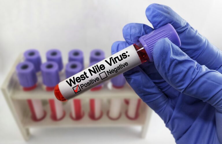 West,Nile,Positive,Blood,Sample